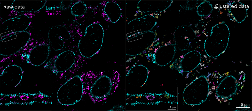 Colorectal cancer clustering