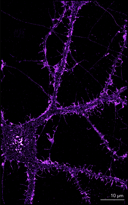 Cortical neurons actin