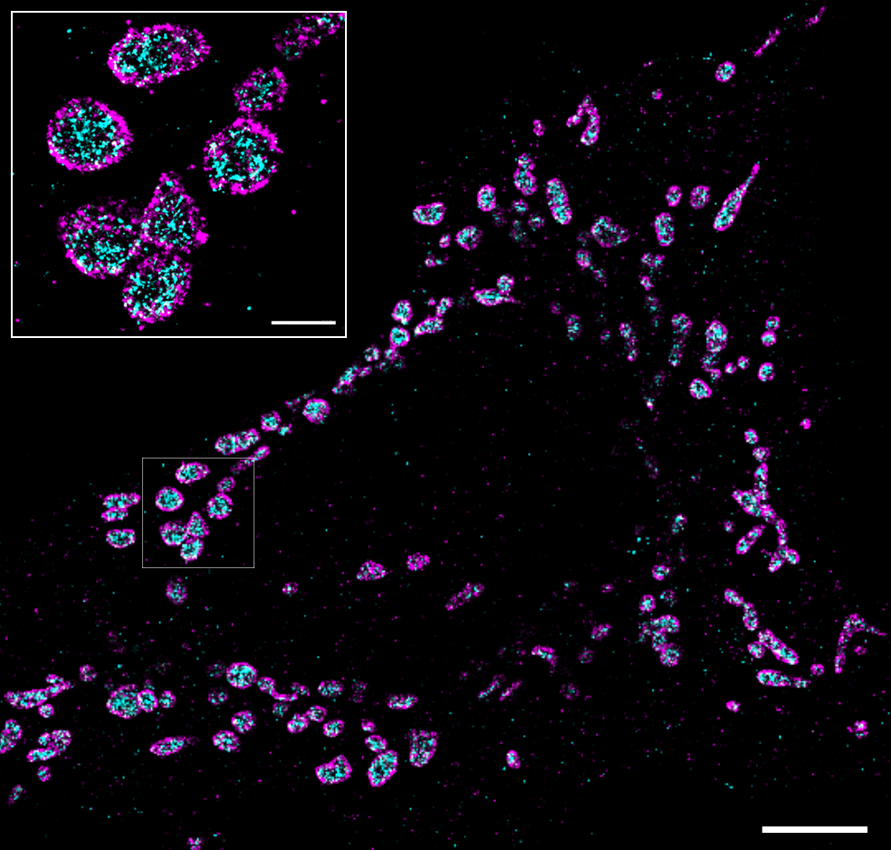 ImmunofluorescenceImage